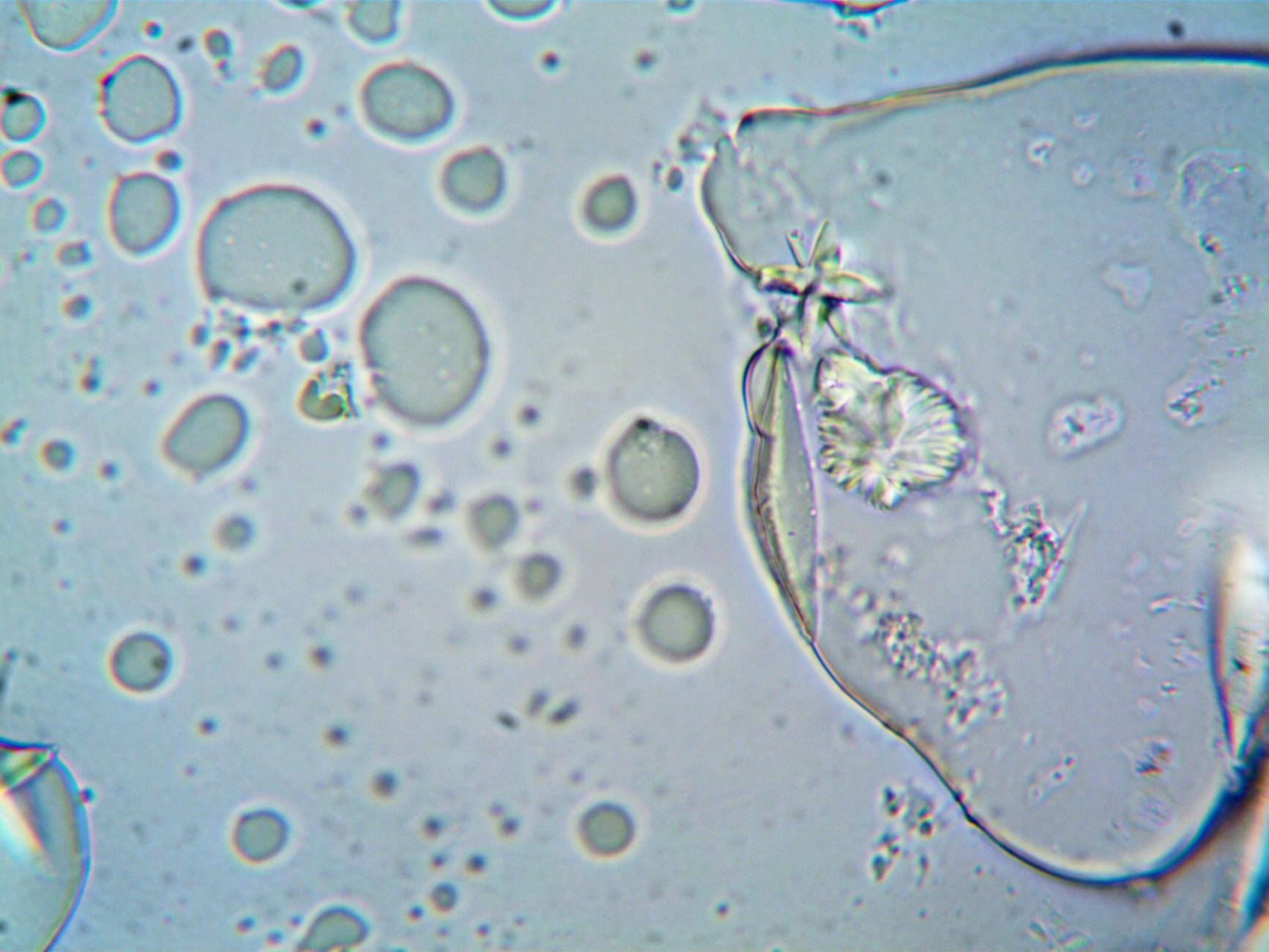 Living chemistry microscopy